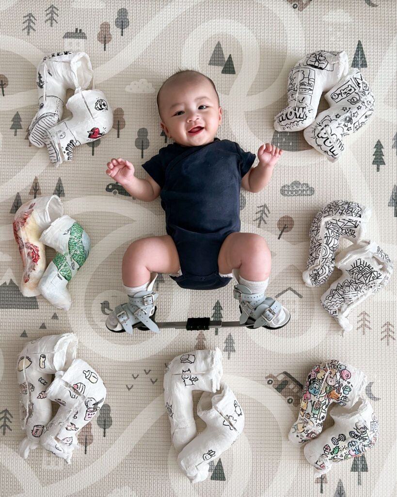 Ansel Lu as a baby | Rare Disorders Society (Singapore) [RDSS]
