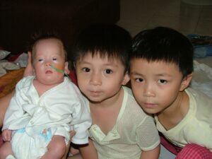 Yong Xuan and her two brothers | Rare Disorders Society (Singapore) [RDSS]